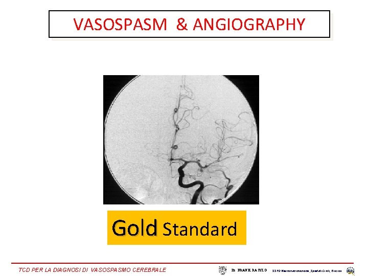 VASOSPASM & ANGIOGRAPHY Gold Standard TCD PER LA DIAGNOSI DI VASOSPASMO CEREBRALE Dr. FRANK
