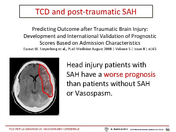 TCD and post-traumatic SAH Predicting Outcome after Traumatic Brain Injury: Development and International Validation