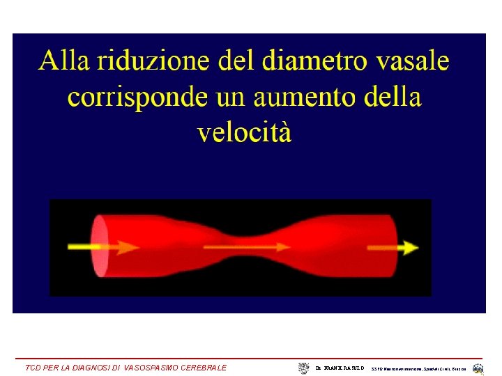 TCD PER LA DIAGNOSI DI VASOSPASMO CEREBRALE Dr. FRANK RASULO SSVD Neurorianimazione , Spedali