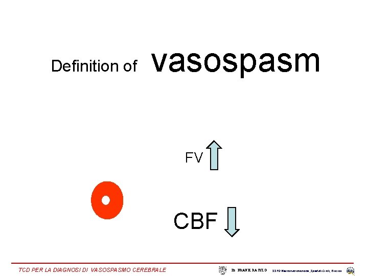 Definition of vasospasm FV CBF TCD PER LA DIAGNOSI DI VASOSPASMO CEREBRALE Dr. FRANK