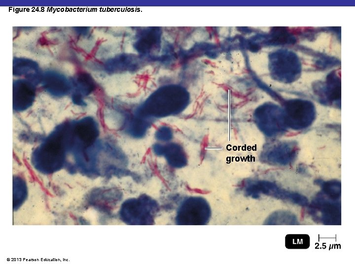 Figure 24. 8 Mycobacterium tuberculosis. Corded growth © 2013 Pearson Education, Inc. 