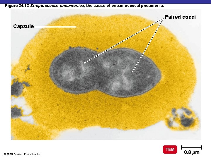 Figure 24. 12 Streptococcus pneumoniae, the cause of pneumococcal pneumonia. Paired cocci Capsule ©