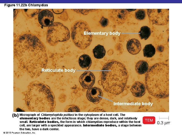 Figure 11. 22 b Chlamydias Elementary body Reticulate body Intermediate body Micrograph of Chlamydophila