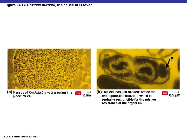 Figure 24. 14 Coxiella burnetii, the cause of Q fever. E Masses of Coxiella