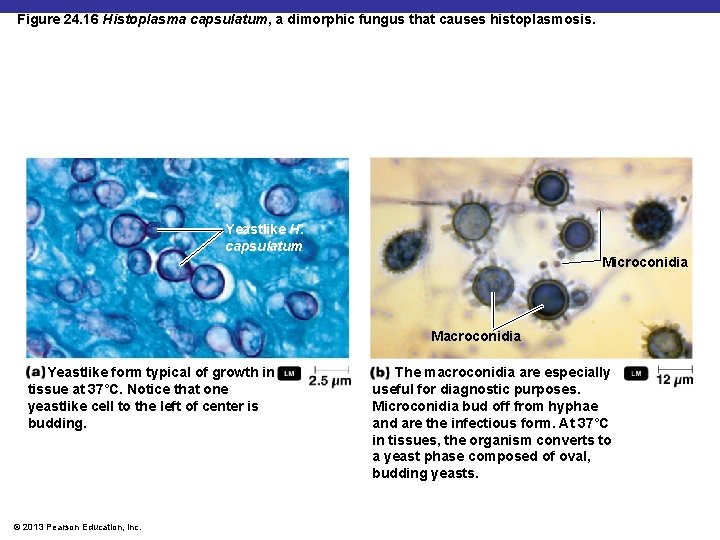 Figure 24. 16 Histoplasma capsulatum, a dimorphic fungus that causes histoplasmosis. Yeastlike H. capsulatum