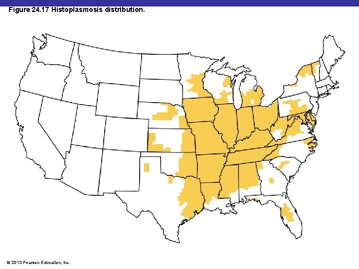 Figure 24. 17 Histoplasmosis distribution. © 2013 Pearson Education, Inc. 