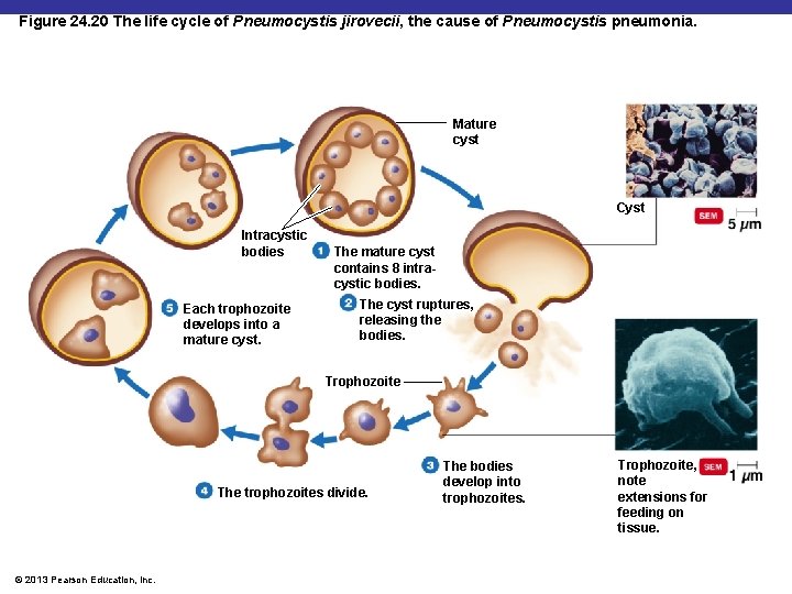 Figure 24. 20 The life cycle of Pneumocystis jirovecii, the cause of Pneumocystis pneumonia.