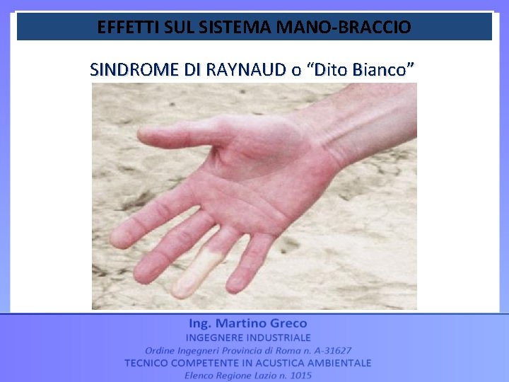 EFFETTI SUL SISTEMA MANO-BRACCIO SINDROME DI RAYNAUD o “Dito Bianco” 