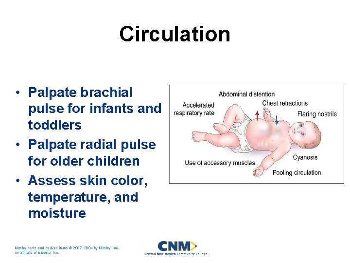 Circulation • Palpate brachial pulse for infants and toddlers • Palpate radial pulse for