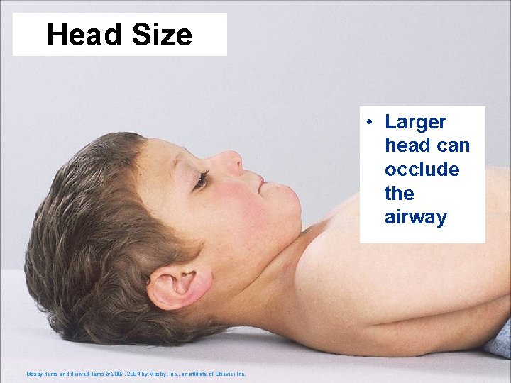 Head Size • Larger head can occlude the airway Mosby items and derived items