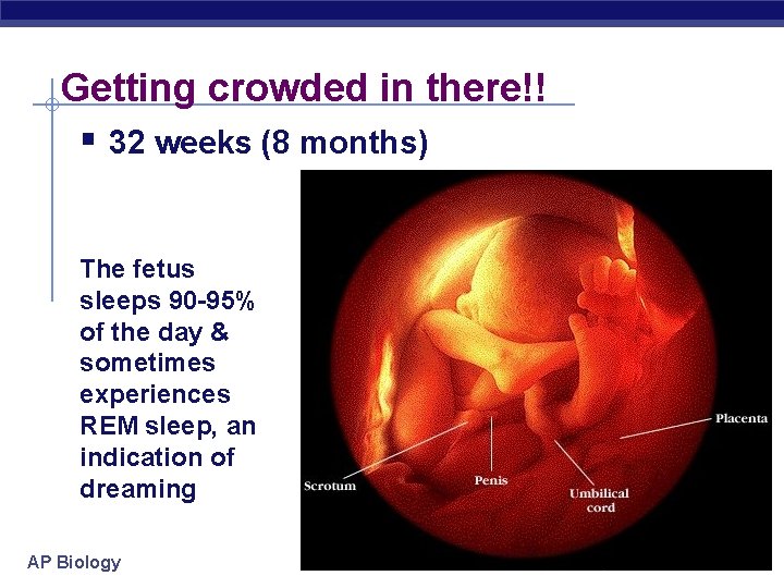 Getting crowded in there!! § 32 weeks (8 months) The fetus sleeps 90 -95%