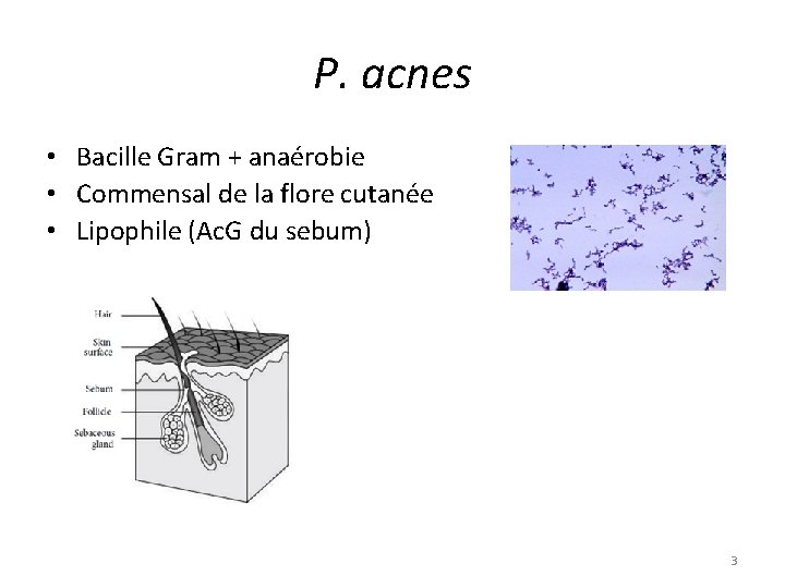 P. acnes • Bacille Gram + anaérobie • Commensal de la flore cutanée •