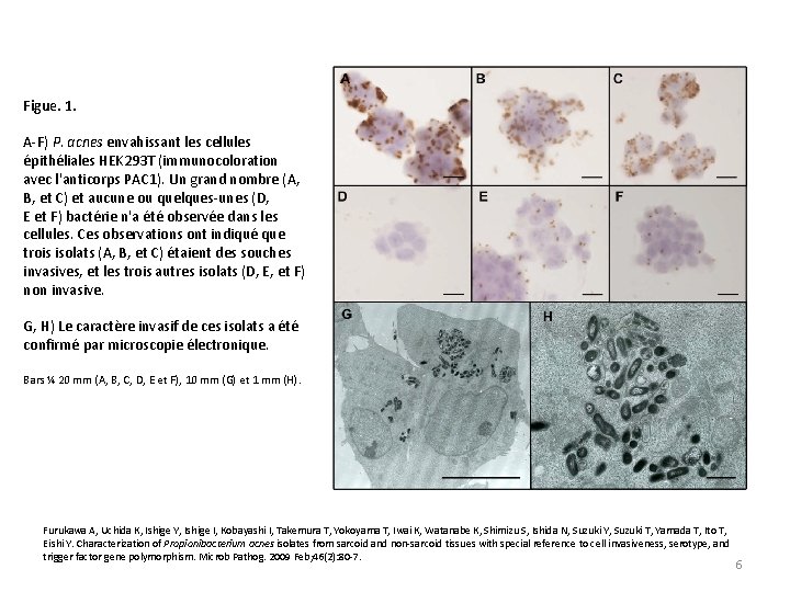 Figue. 1. A-F) P. acnes envahissant les cellules épithéliales HEK 293 T (immunocoloration avec