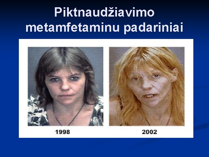 Piktnaudžiavimo metamfetaminu padariniai 