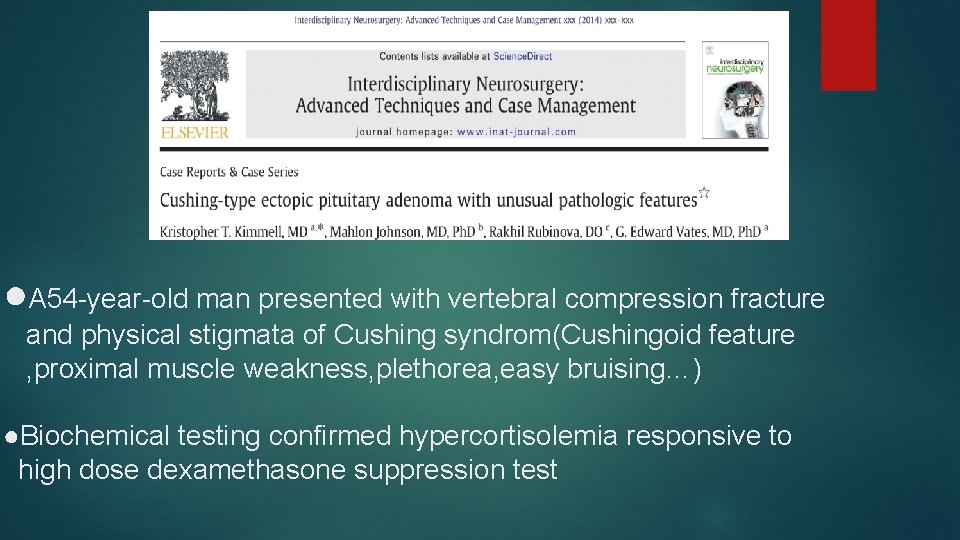●A 54 -year-old man presented with vertebral compression fracture and physical stigmata of Cushing