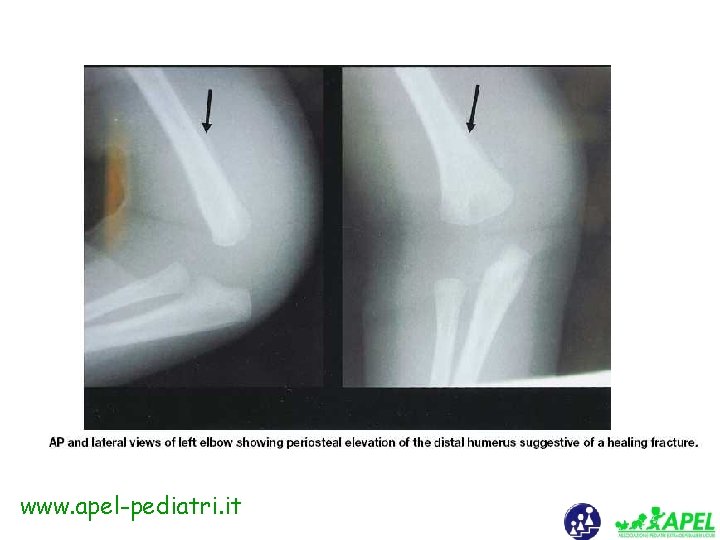 www. apel-pediatri. it 