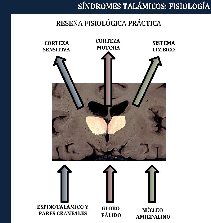 SÍNDROMES TALÁMICOS: FISIOLOGÍA RESEÑA FISIOLÓGICA PRÁCTICA CORTEZA SENSITIVA ESPINOTALÁMICO Y PARES CRANEALES CORTEZA MOTORA