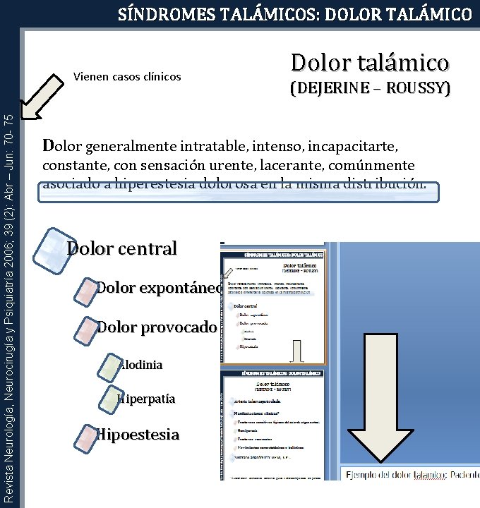 SÍNDROMES TALÁMICOS: DOLOR TALÁMICO Revista Neurología, Neurocirugía y Psiquiatría 2006; 39 (2): Abr –