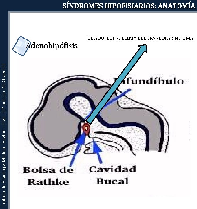 SÍNDROMES HIPOFISIARIOS: ANATOMÍA Tratado de Fisiología Médica. Guyton – Hall, 10ª edición. Mc. Graw