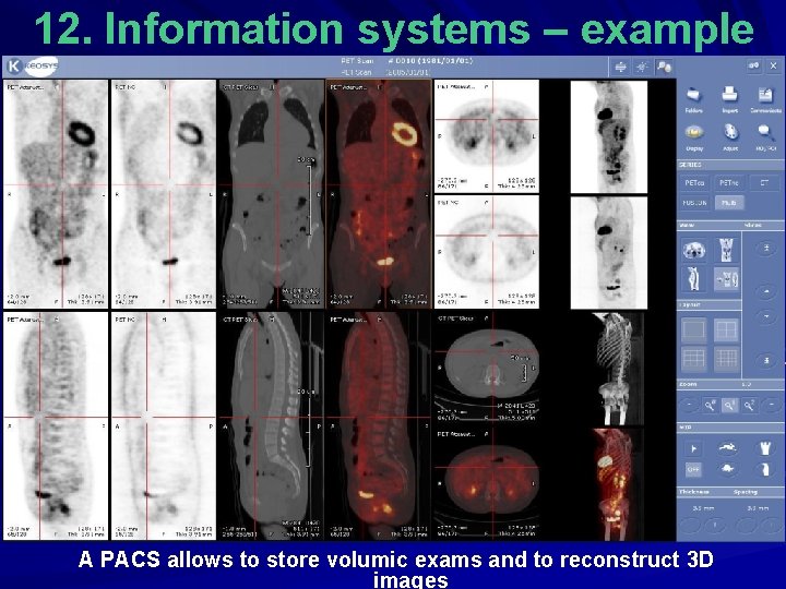 12. Information systems – example A PACS allows to store volumic exams and to