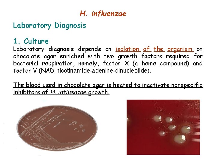 H. influenzae Laboratory Diagnosis 1. Culture Laboratory diagnosis depends on isolation of the organism