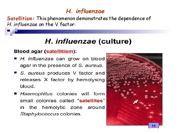 H. influenzae Satellitism: This phenomenon demonstrates the dependence of H. influenzae on the V