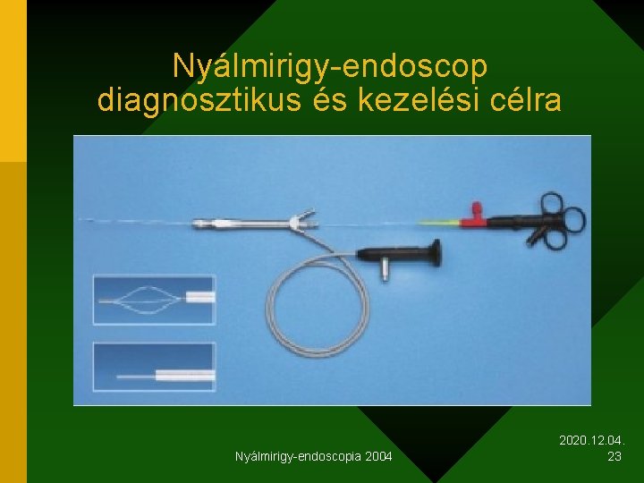 Nyálmirigy-endoscop diagnosztikus és kezelési célra Nyálmirigy-endoscopia 2004 2020. 12. 04. 23 