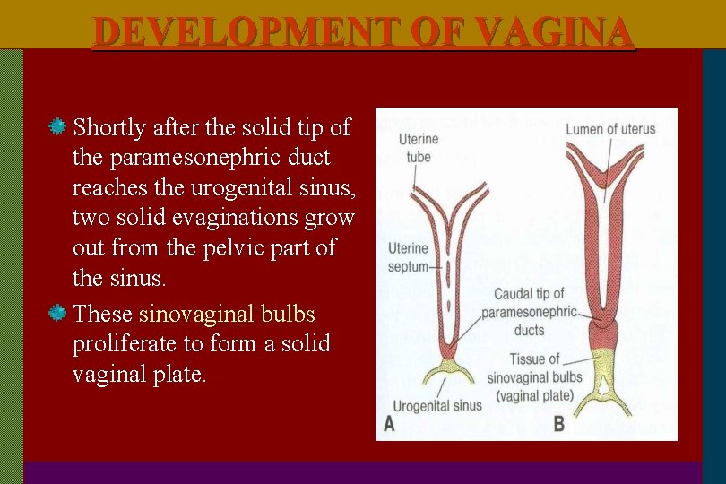 DEVELOPMENT OF VAGINA Shortly after the solid tip of the paramesonephric duct reaches the