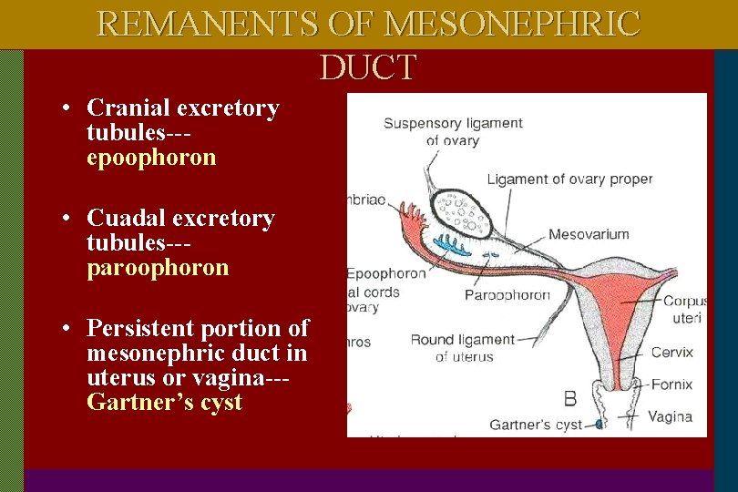 REMANENTS OF MESONEPHRIC DUCT • Cranial excretory tubules--epoophoron • Cuadal excretory tubules--paroophoron • Persistent