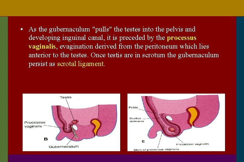  • As the gubernaculum "pulls" the testes into the pelvis and developing inguinal