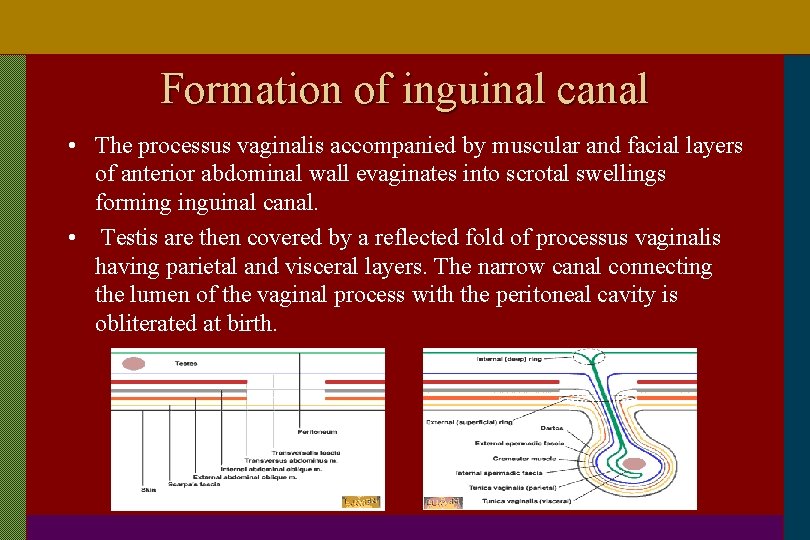 Formation of inguinal canal • The processus vaginalis accompanied by muscular and facial layers