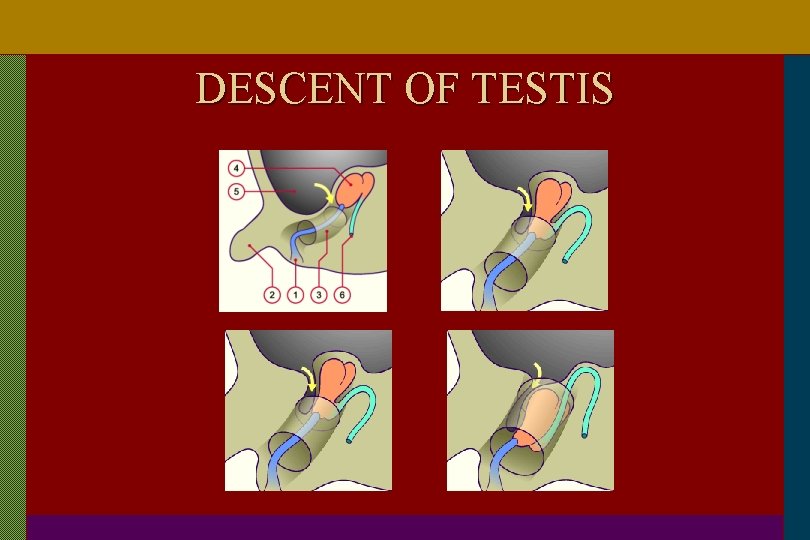 DESCENT OF TESTIS 
