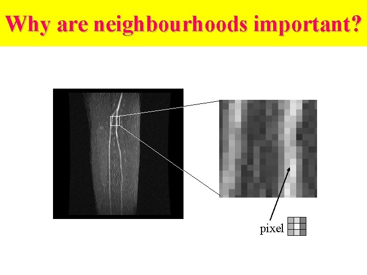 Why are neighbourhoods important? pixel 
