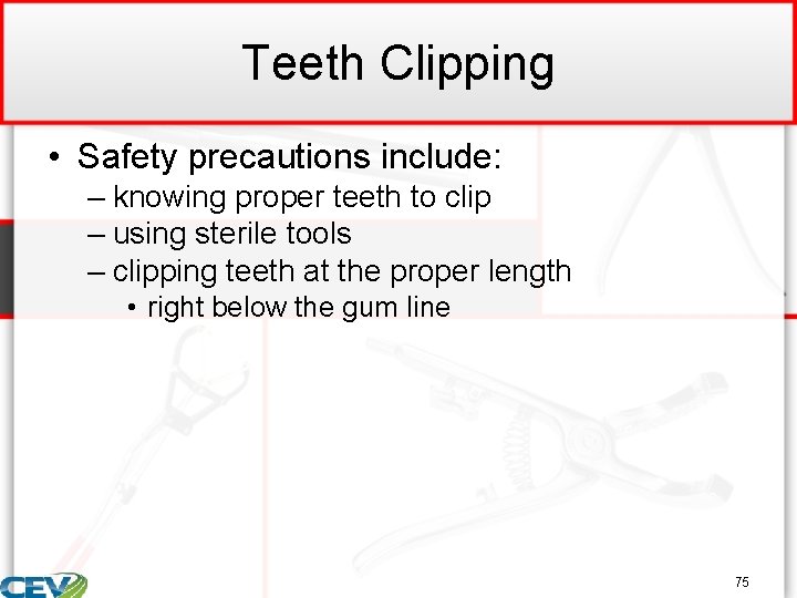 Teeth Clipping • Safety precautions include: – knowing proper teeth to clip – using