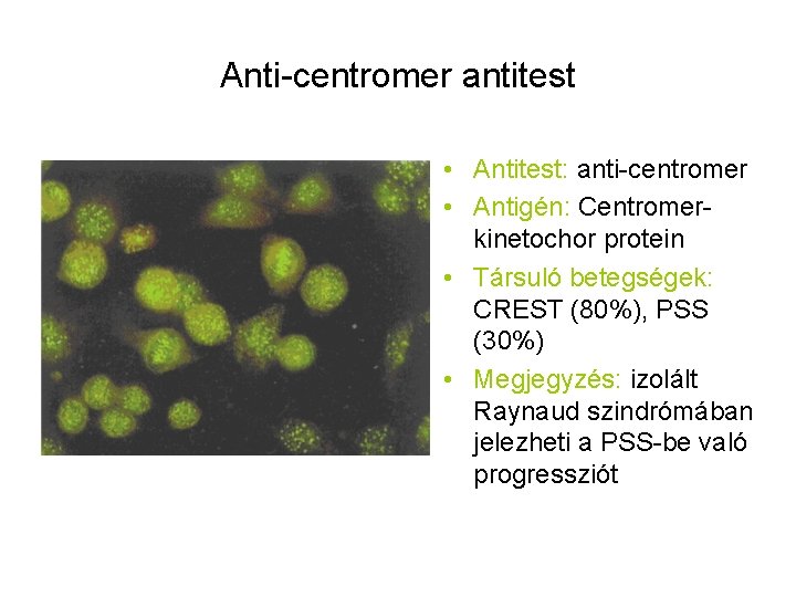 Anti-centromer antitest • Antitest: anti-centromer • Antigén: Centromerkinetochor protein • Társuló betegségek: CREST (80%),