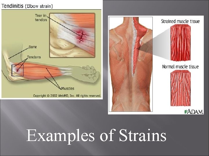 Examples of Strains 