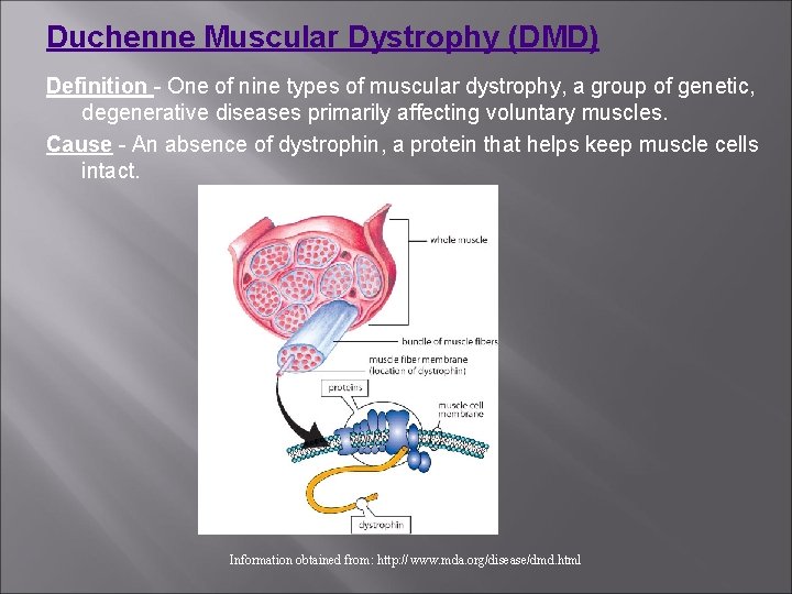 Duchenne Muscular Dystrophy (DMD) Definition - One of nine types of muscular dystrophy, a