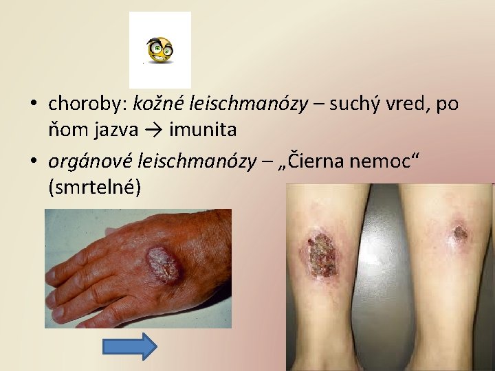  • choroby: kožné leischmanózy – suchý vred, po ňom jazva → imunita •