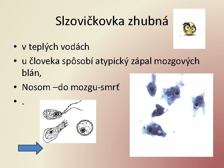 Slzovičkovka zhubná • v teplých vodách • u človeka spôsobí atypický zápal mozgových blán,