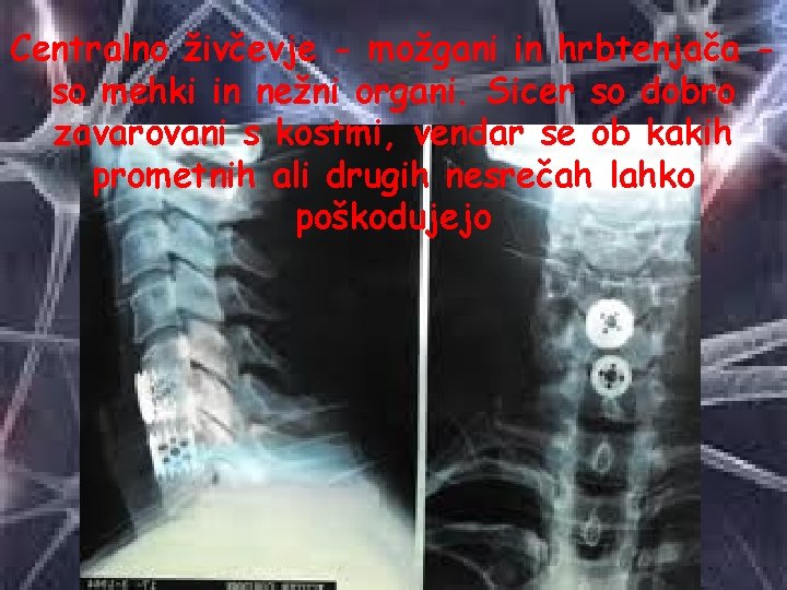 Centralno živčevje - možgani in hrbtenjača so mehki in nežni organi. Sicer so dobro