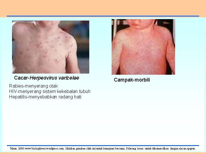 Cacar-Herpesvirus varizelae Campak-morbili Rabies-menyerang otak HIV-menyerang sistem kekebalan tubuh Hepatitis-menyebabkan radang hati Tahun 2008
