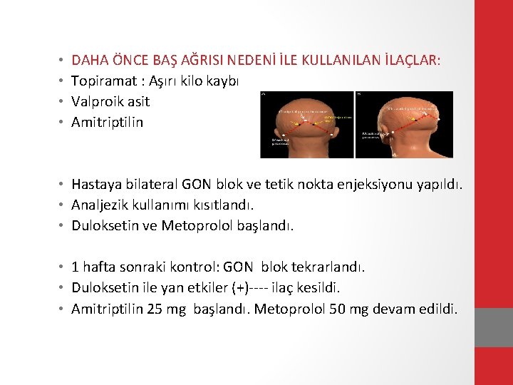  • • DAHA ÖNCE BAŞ AĞRISI NEDENİ İLE KULLANILAN İLAÇLAR: Topiramat : Aşırı