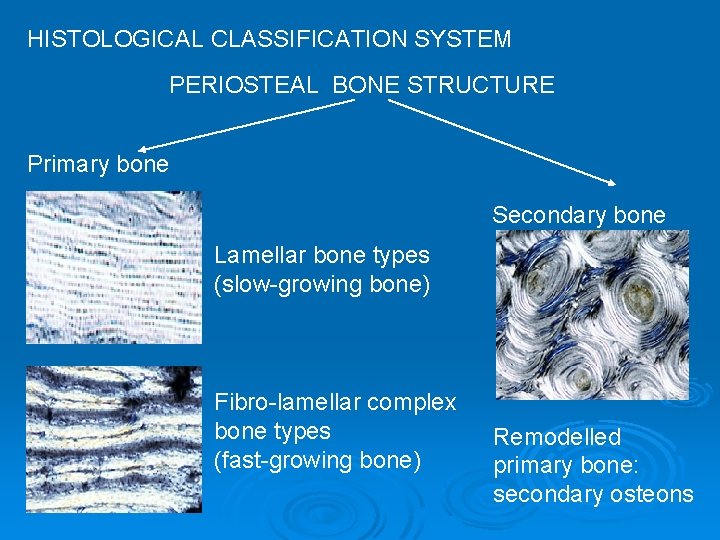 HISTOLOGICAL CLASSIFICATION SYSTEM PERIOSTEAL BONE STRUCTURE Primary bone Secondary bone Lamellar bone types (slow-growing