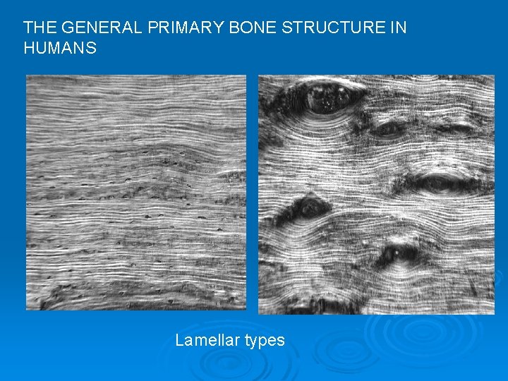 THE GENERAL PRIMARY BONE STRUCTURE IN HUMANS Lamellar types 