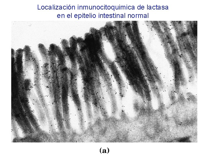 Localización inmunocitoquimica de lactasa en el epitelio intestinal normal 