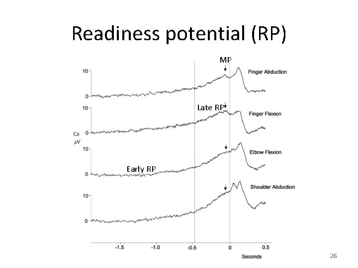 Readiness potential (RP) MP Late RP Early RP 26 