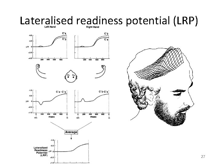 Lateralised readiness potential (LRP) 27 