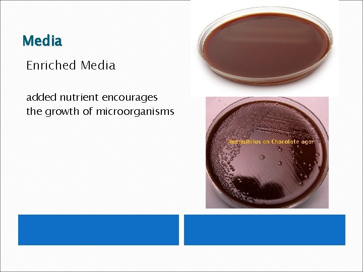 Media Enriched Media added nutrient encourages the growth of microorganisms 