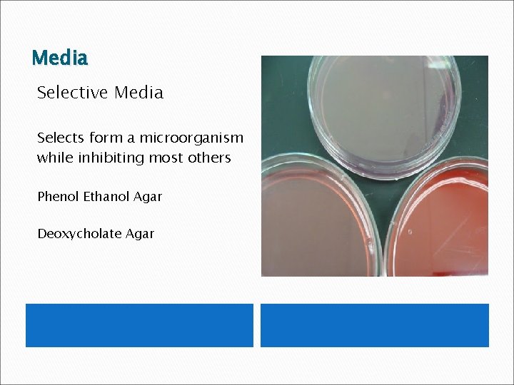 Media Selective Media Selects form a microorganism while inhibiting most others Phenol Ethanol Agar