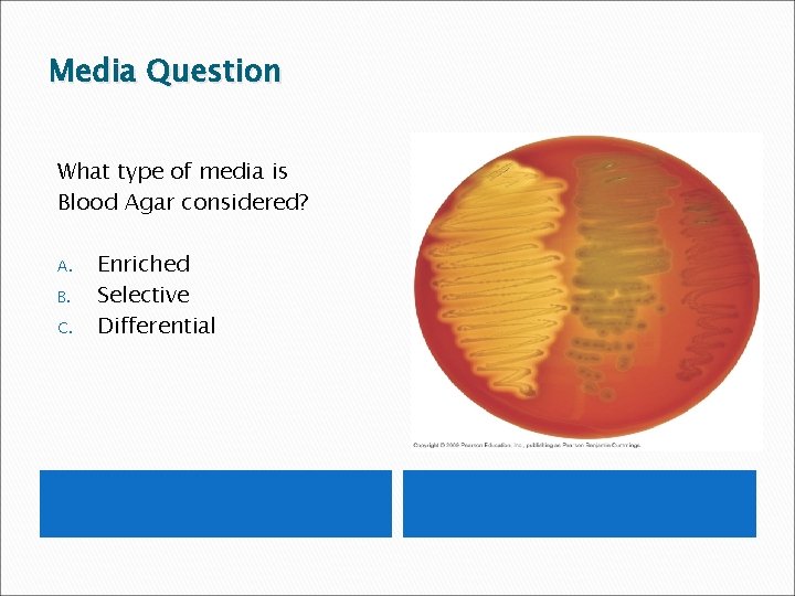 Media Question What type of media is Blood Agar considered? A. B. C. Enriched